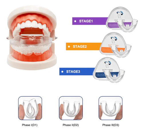 Invisible Braces